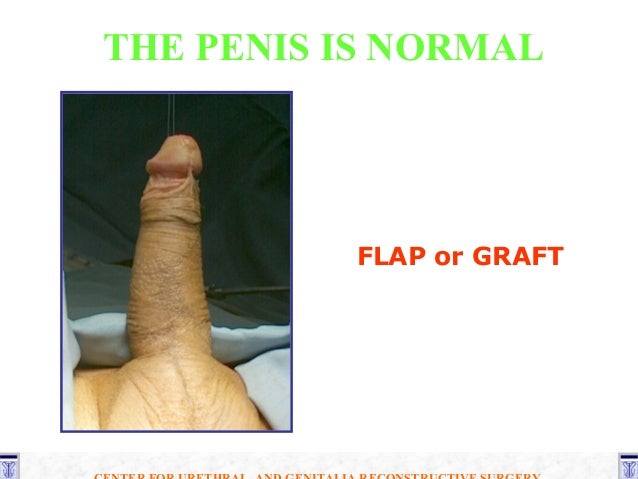 pics ofnormal penis Breast cancer effect amino acid